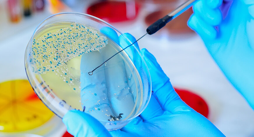 2 Days Hands on Training Program in Microbiology
